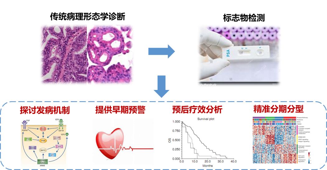 Urine proteomics，生物标志物筛选新利器